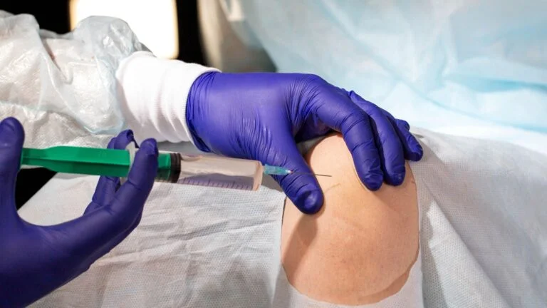 ChondroFiller Injection