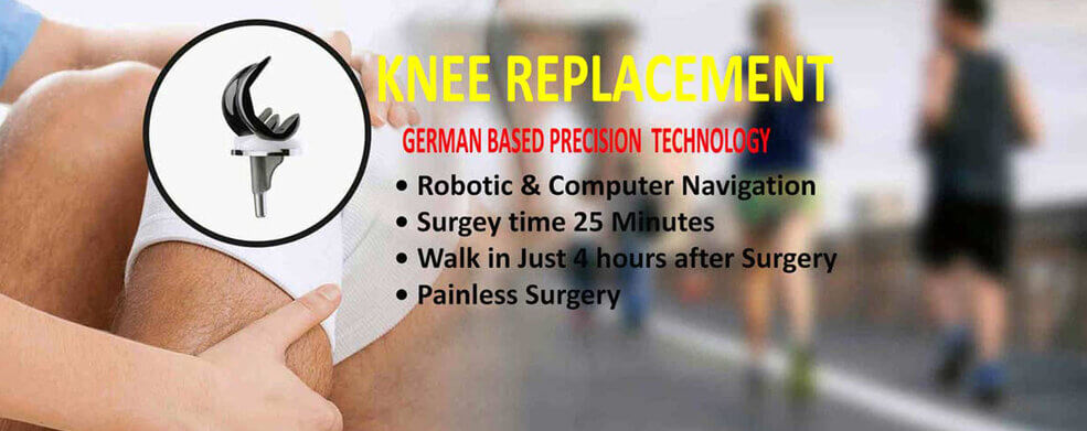 Best Knee Replacement Surgery in Hyderabad
