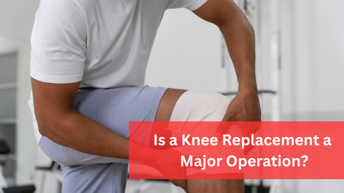 Is a Knee Replacement a Major Operation